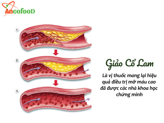 Giảo cổ lam “thần dược” trị mỡ máu mang lại hiệu quả cao 