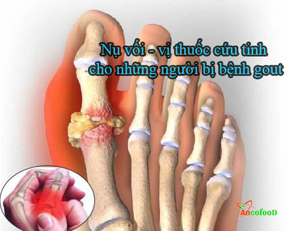 Tìm hiểu về công dụng và cách dùng nụ vối chữa bệnh tốt nhất