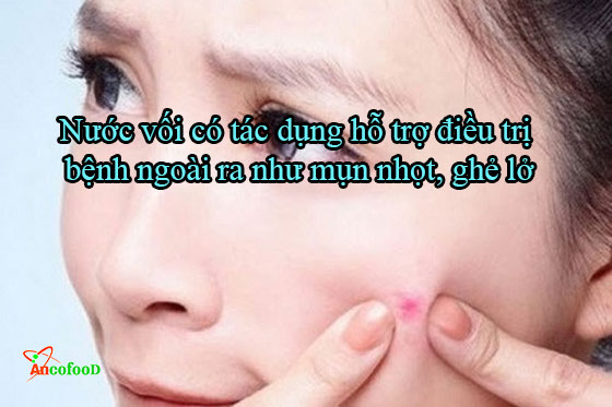 Tìm hiểu về công dụng và cách dùng nụ vối chữa bệnh tốt nhất